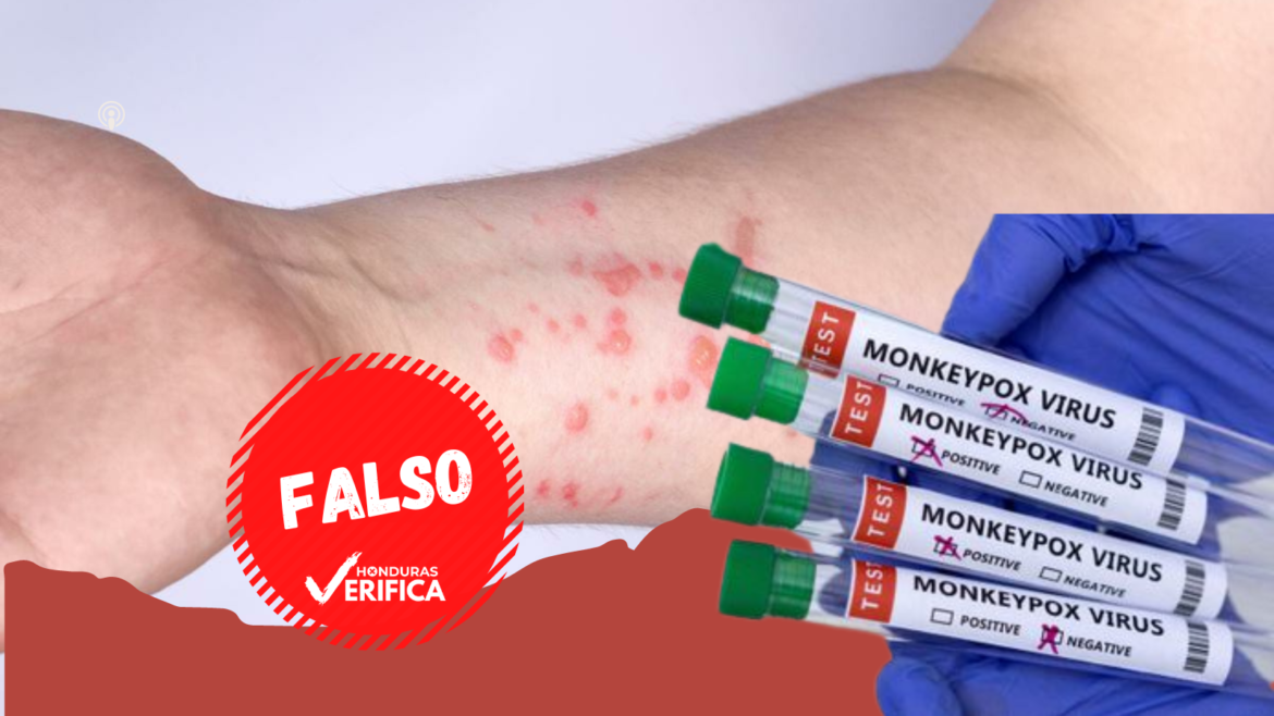 Fake News en torno a la viruela del mono